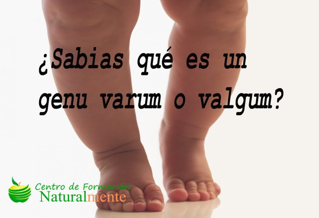 Alteraciones en varo y valgo de la rodilla