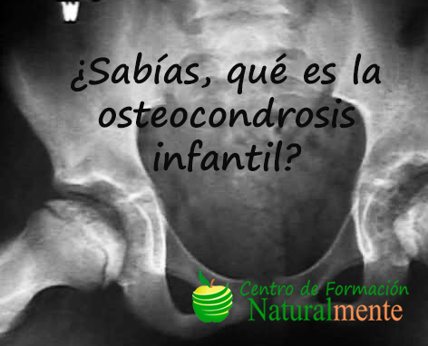 Osteocondrosis en la infancia y adolescencia