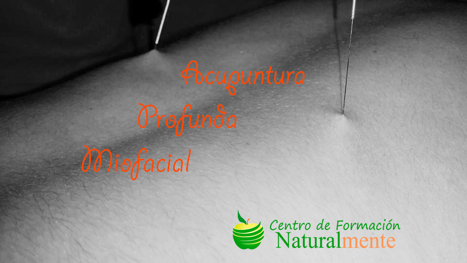 El beneficio de la Acupuntura Profunda Miofascial