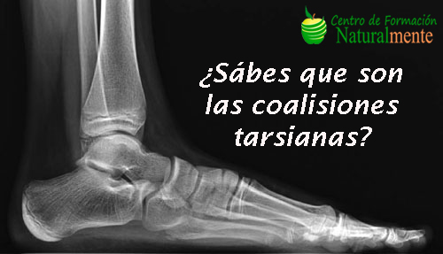 ¿Sabes que es una coalición tarsiana?